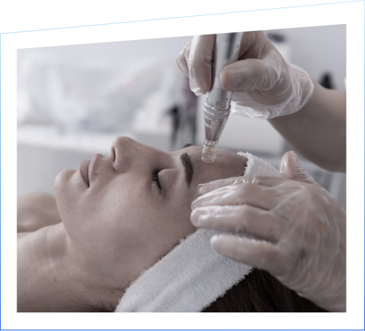 Microneedling Treatments - Defiant Health Spa